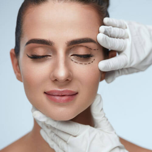 Woman Being Prepped for Eyelid Surgery