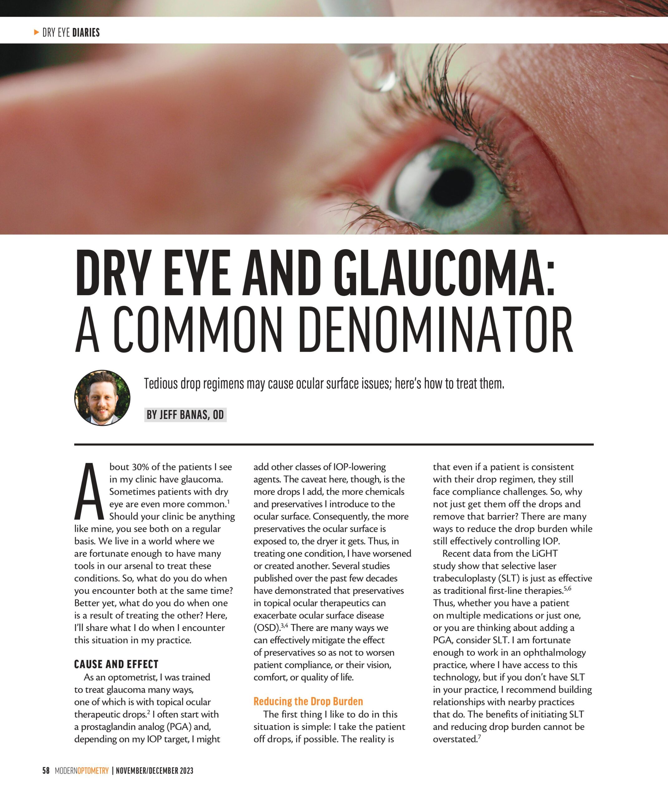 Dry Eye and Glaucoma